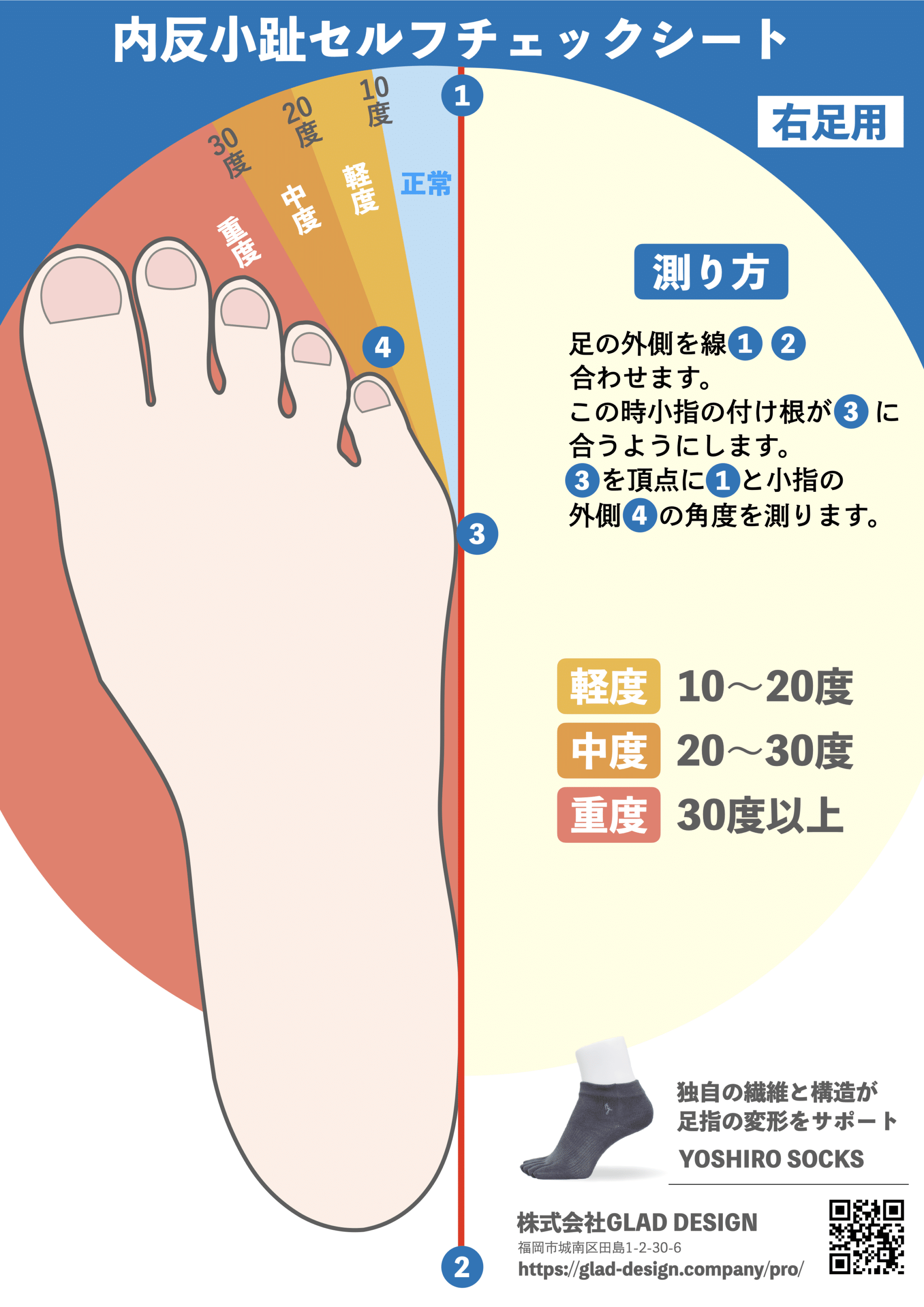 内反小趾セルフチェックシートで足指の変形を確認しましょう！ | 足指 