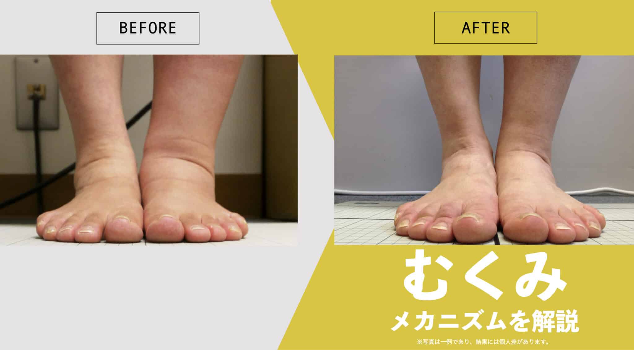 当時のメディア報道・掲載写真