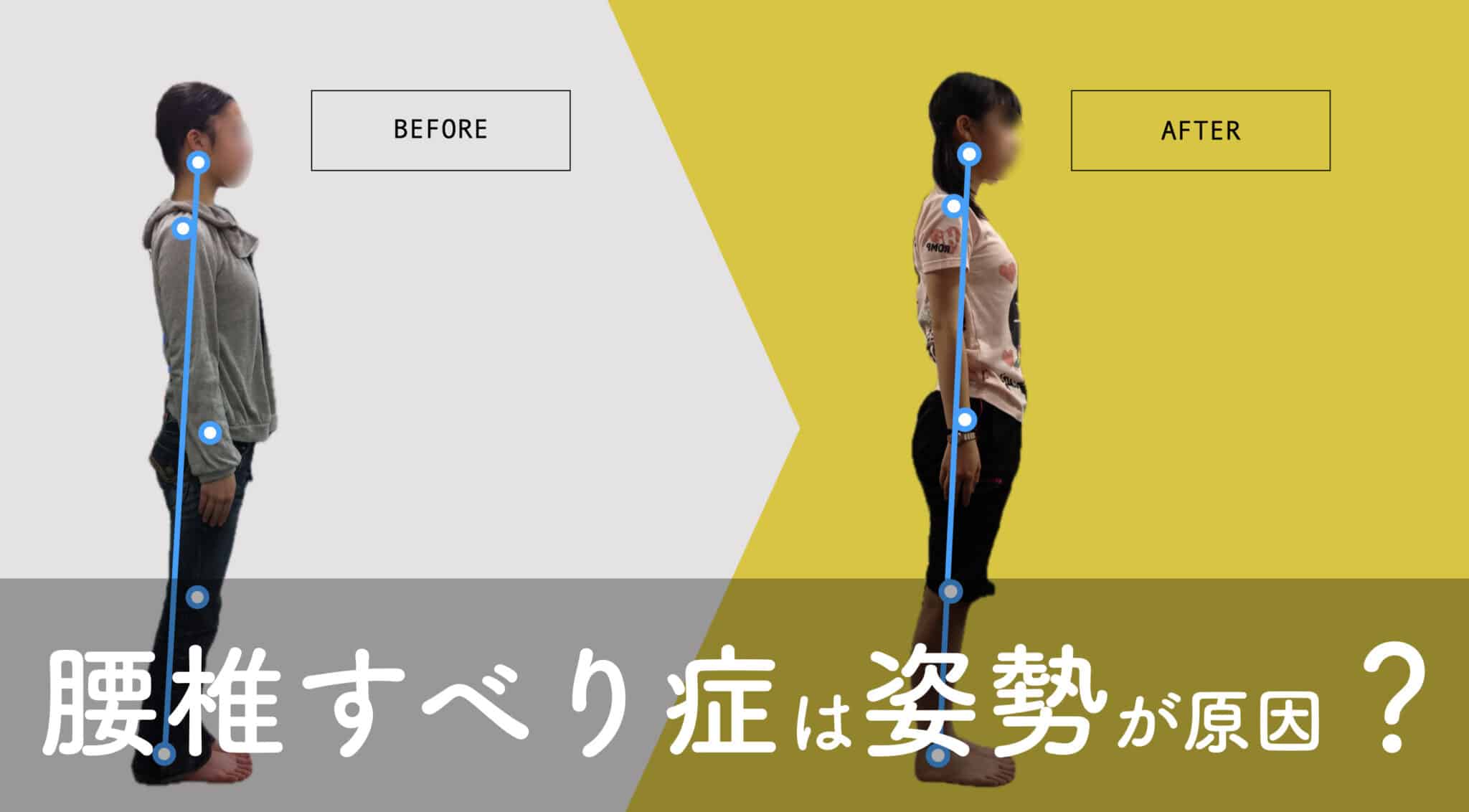 腰のすべり症最新最強自力克服大全 腰のすべり症・側弯症・脊柱管狭窄症 最新最強 自力克服大全
