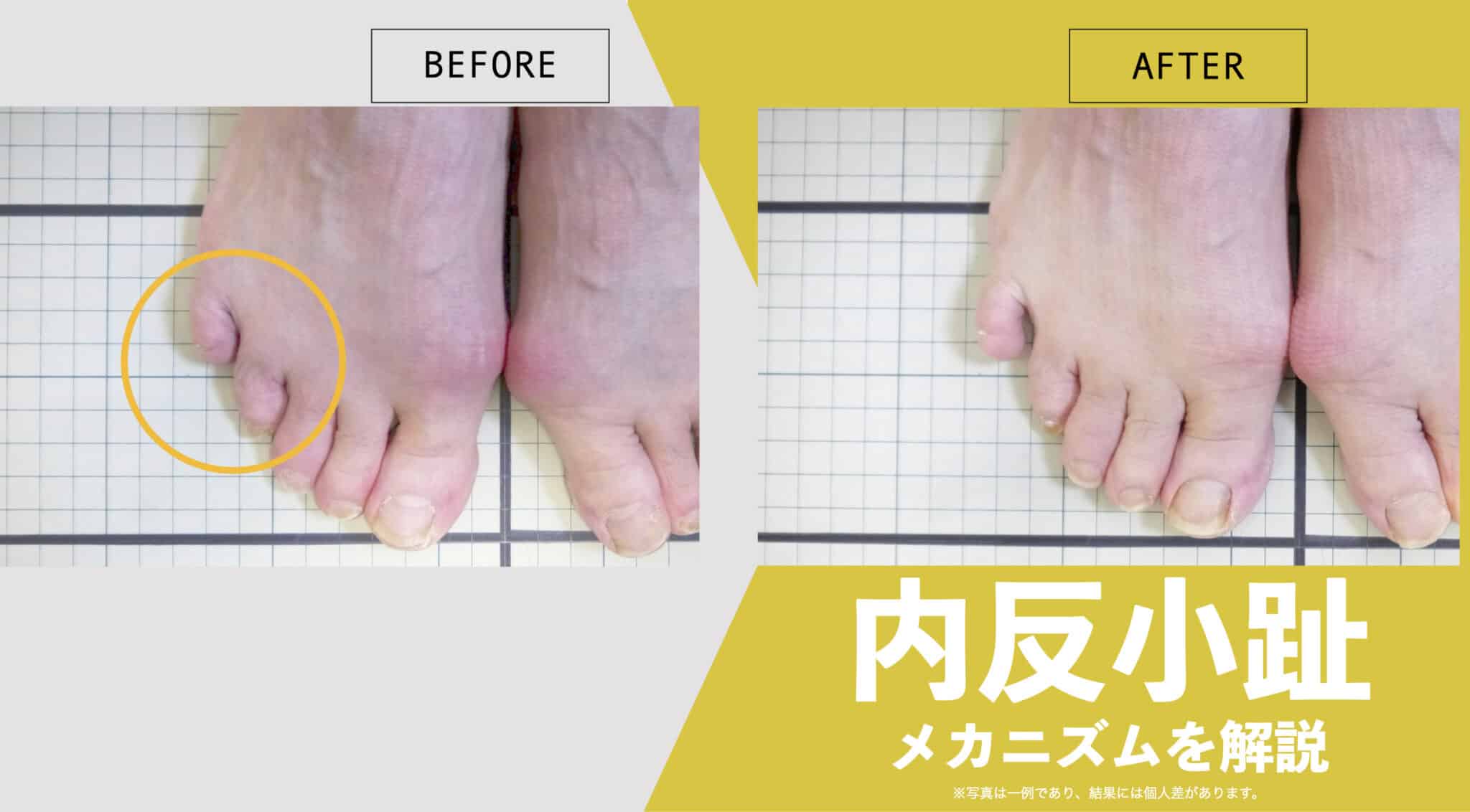 【医療監修】足の指の正しい呼び方と役割——母趾から小趾までを知れば健康が変わる | 湯浅慶朗【公式】足指研究所